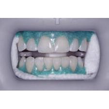 Barrière gingivale à photopolymérisation Venus White® Max – Seringues de 1,2 ml, 4/emballage