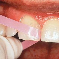 Bandes Polystrips Super-Snap®, 100/emballage