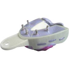 Miratray® porte-empreinte Implant Advanced, 6/emballage