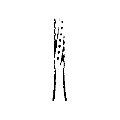 1695618