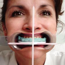 Facial Plane Relator