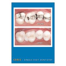CEREC Personalized Postcards, 100/Pkg