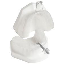 myTAP Precision-Fit Oral Appliance