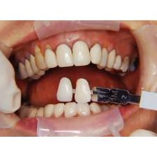 Dr. Christensen's Complex Oral Rehabilitation DVD