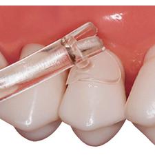 Cure-Thru® Clear Cervical Matrices, Assorted Package