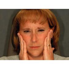 Dr. Christensen's Simple TMD Therapy for Your Practice DVD