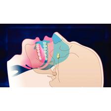 Dr. Christensen's Snoring and Sleep Apnea DVD