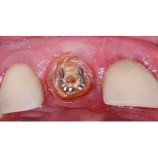 Dr. Christensen's How to Repair and Maintain Fixed Restorations DVD