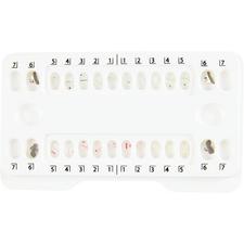 Patterson® A Roth Ceramic Twin Brackets 1 Patient Kits, .022