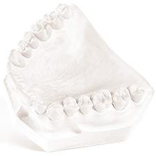 OrthoStone – White, 25 lb