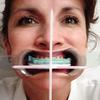 Facial Plane Relator