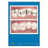 CEREC Personalized Postcards, 100/Pkg