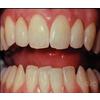 Dr. Christensen's Clinical Tips For Hygienists From Dentists DVD
