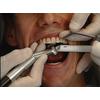 Dr. Christensen's Removal of Superficial Tooth Stains DVD