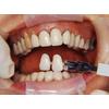 Dr. Christensen's Complex Oral Rehabilitation DVD