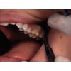 Dr. Christensen's Easy Third Molar Extraction DVD