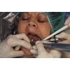 Dr. Christensen's Placing Mini Implants DVD