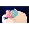 Dr. Christensen's Snoring and Sleep Apnea DVD