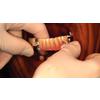 Dr. Christensen's Predictable Removable Partial Dentures DVD