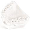 OrthoStone – White, 25 lb