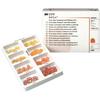 Sof-Lex™ Extra-Thin Contouring and Polishing Discs Kit